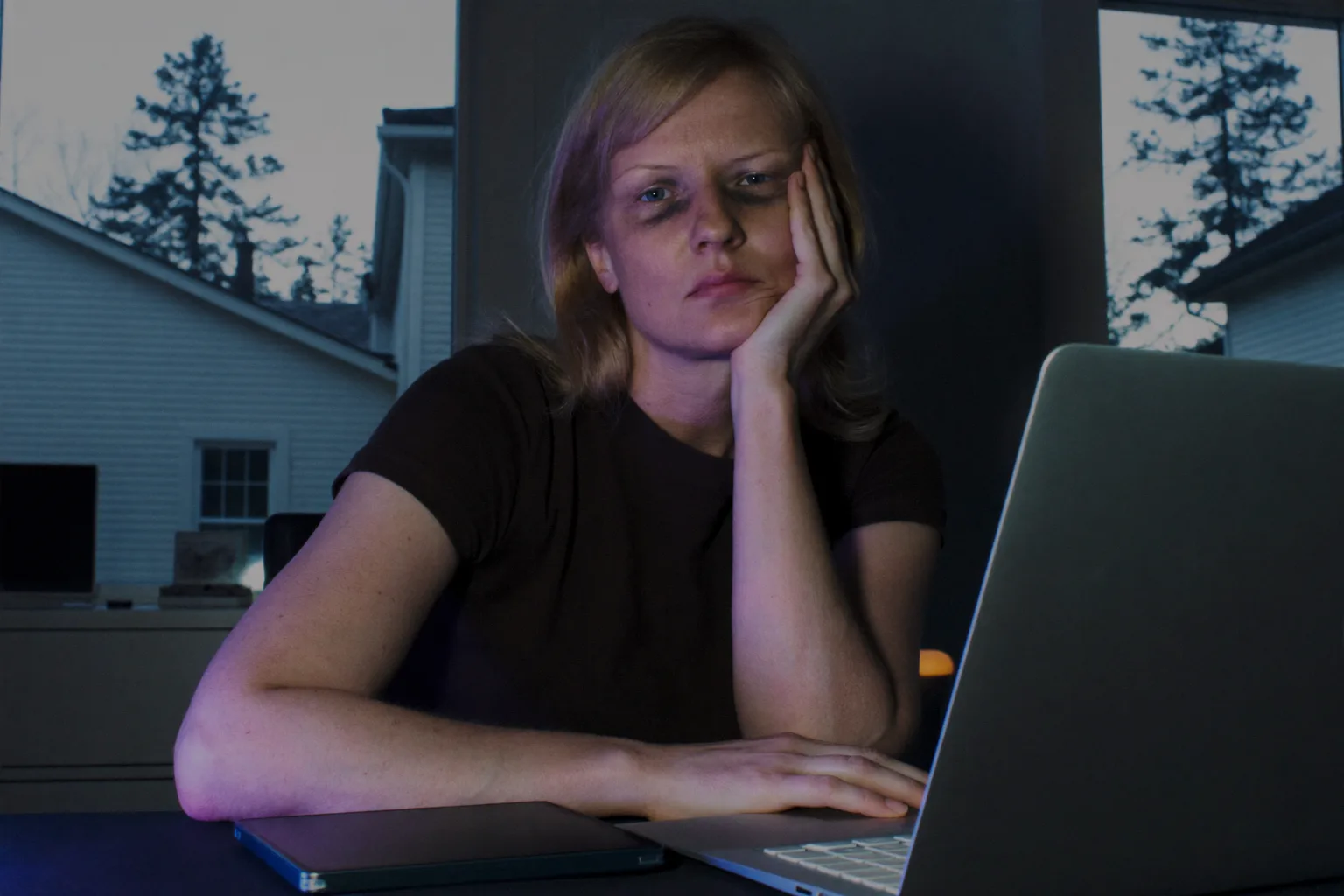 En træt kvinde ved en bærbar computer sent på dagen, som hviler hovedet i hånden, med tunge, tørre øjne og mørke rande under øjnene i et dæmpet oplyst rum
